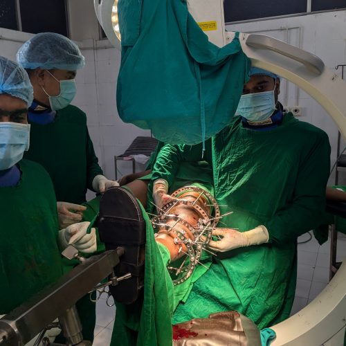 Ilizarov Surgery of Orthopedics